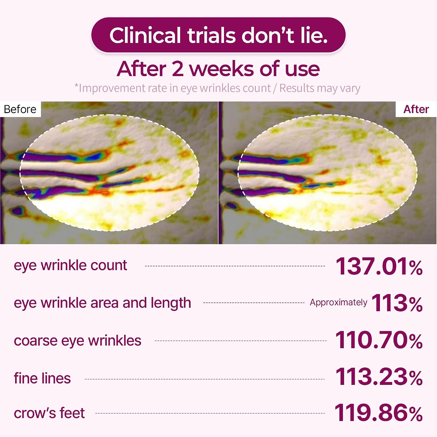 Under-Eye Volume Patches