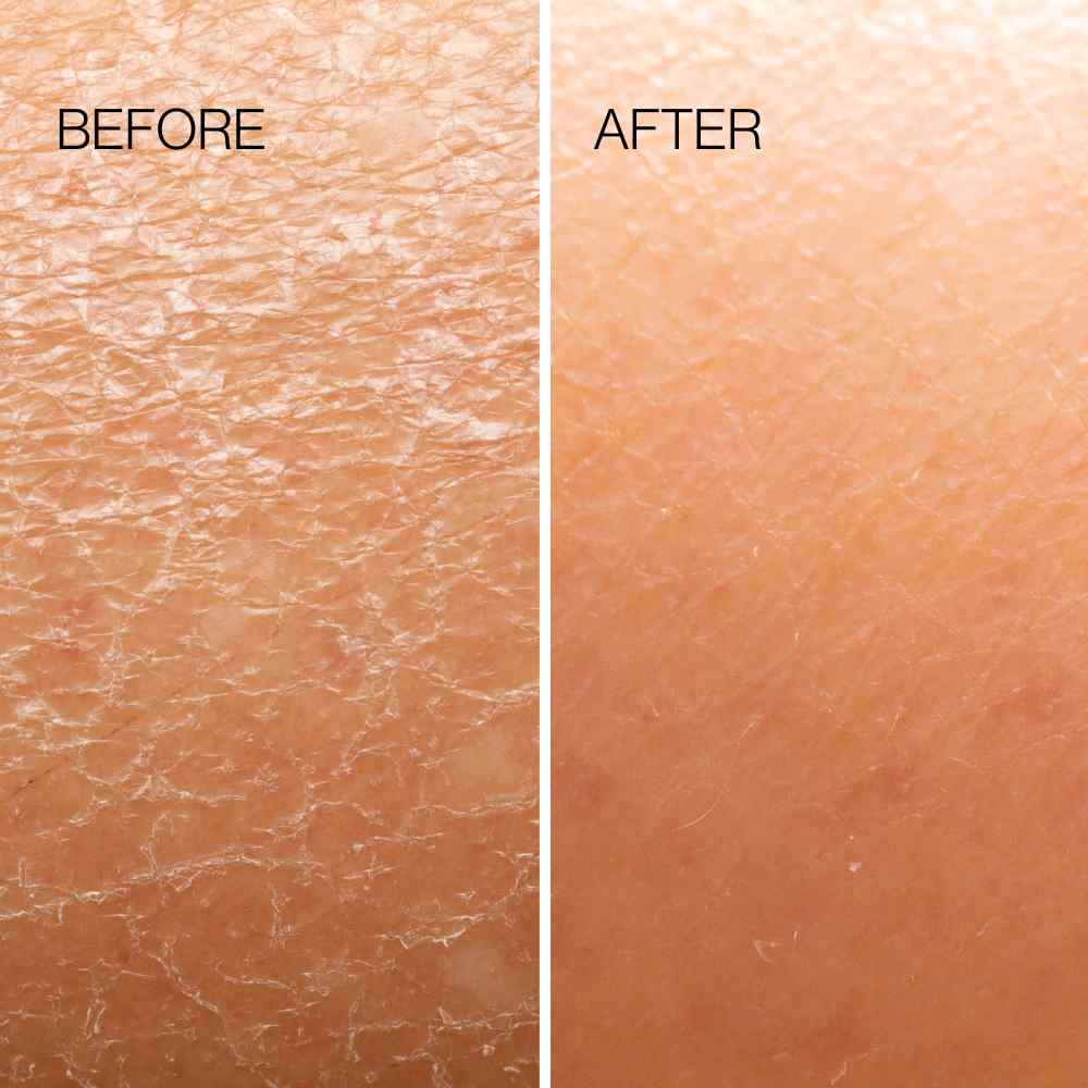 Body Exfoliation Plane